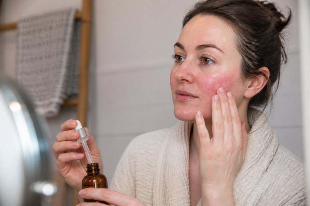 Can You Use Vitamin C on Rosacea Skin? Yes, Here's How
